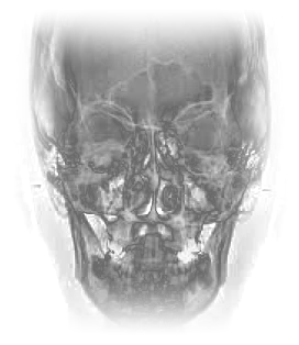 Dental X-ray skull