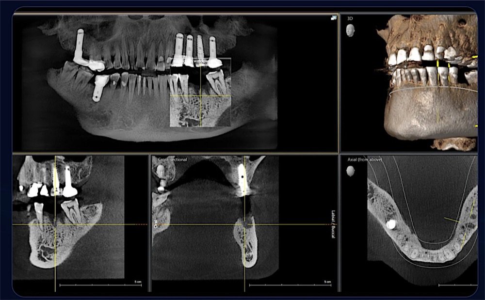 Panoramic, cross-sectional, axial and 3D CBCT views in one screen