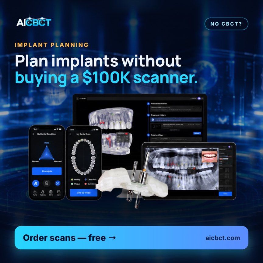 Plan implants without buying a scanner