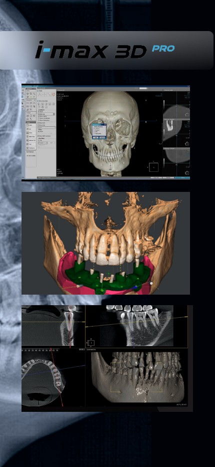 Owandy I-Max 3D Pro