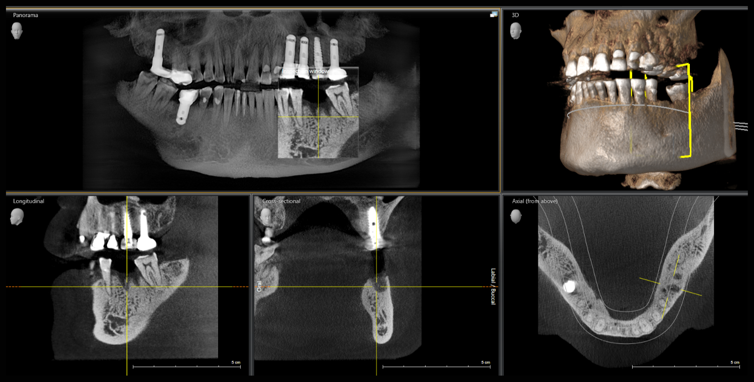 Sample CBCT views