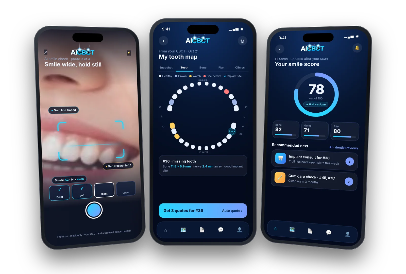 AICBCT app: Dr. Conner dancing, tooth map from the patient's CBCT, smile score with recommended next steps